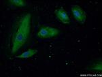 ASMTL Antibody in Immunocytochemistry (ICC/IF)