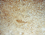 ASMTL Antibody in Immunohistochemistry (Paraffin) (IHC (P))