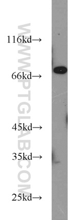 ASMTL Antibody in Western Blot (WB)