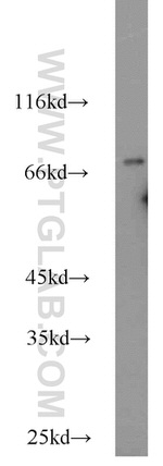 ASMTL Antibody in Western Blot (WB)