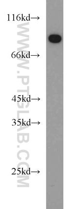 ASMTL Antibody in Western Blot (WB)