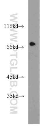 ASMTL Antibody in Western Blot (WB)