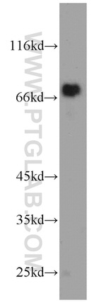 ASMTL Antibody in Western Blot (WB)