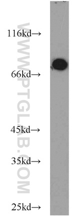 ASMTL Antibody in Western Blot (WB)