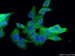 S100A13 Antibody in Immunocytochemistry (ICC/IF)