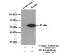 DARS Antibody in Immunoprecipitation (IP)