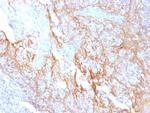 Catenin, beta (p120) Antibody in Immunohistochemistry (Paraffin) (IHC (P))