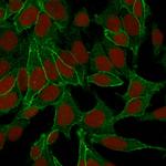 Catenin, beta (p120) Monoclonal Antibody (6F9)