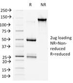 Catenin, beta (p120) Antibody in SDS-PAGE (SDS-PAGE)