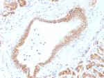 Catenin, beta (p120) Antibody in Immunohistochemistry (Paraffin) (IHC (P))