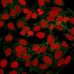 Catenin, beta (p120) Recombinant Rabbit Monoclonal Antibody (CTNNB1, 2030R)