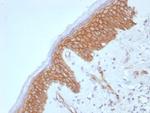Catenin, beta (CTNNB1) Antibody in Immunohistochemistry (Paraffin) (IHC (P))