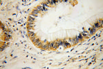 RPL14 Antibody in Immunohistochemistry (Paraffin) (IHC (P))