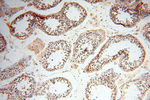 HIRIP3 Antibody in Immunohistochemistry (Paraffin) (IHC (P))