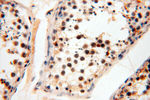 HIRIP3 Antibody in Immunohistochemistry (Paraffin) (IHC (P))