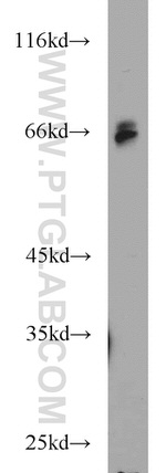 HIRIP3 Antibody in Western Blot (WB)