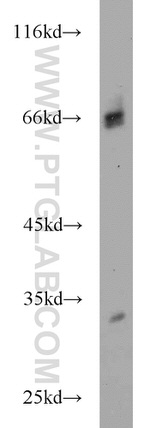 HIRIP3 Antibody in Western Blot (WB)