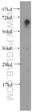 HIRIP3 Antibody in Western Blot (WB)