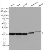 METTL1 Antibody in Western Blot (WB)