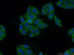 DDA1 Antibody in Immunocytochemistry (ICC/IF)