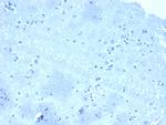 p120/Catenin, delta-1 (CTNND1) Monoclonal Antibody (CTNND1/4501)