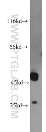 UNKL Antibody in Western Blot (WB)