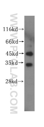 UNKL Antibody in Western Blot (WB)