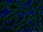 TCTN1 Antibody in Immunohistochemistry (PFA fixed) (IHC (PFA))