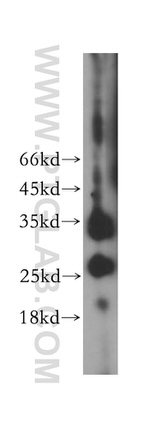 PRSS2 Antibody in Western Blot (WB)