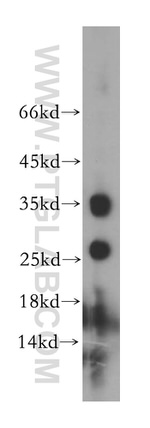 PRSS2 Antibody in Western Blot (WB)
