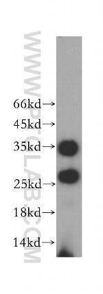PRSS2 Antibody in Western Blot (WB)