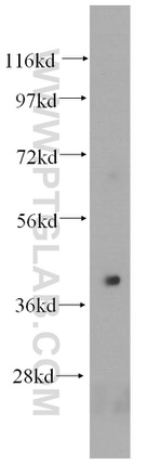 HLA-E Antibody in Western Blot (WB)