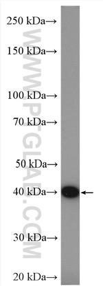 HLA-E Antibody in Western Blot (WB)