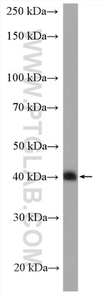 HLA-E Antibody in Western Blot (WB)
