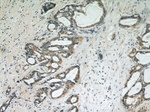 SKP2 Antibody in Immunohistochemistry (Paraffin) (IHC (P))