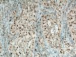 SKP2 Antibody in Immunohistochemistry (Paraffin) (IHC (P))