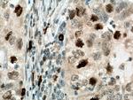 SKP2 Antibody in Immunohistochemistry (Paraffin) (IHC (P))