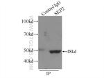 SKP2 Antibody in Immunoprecipitation (IP)