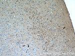MYO1B Antibody in Immunohistochemistry (Paraffin) (IHC (P))