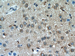 MYO1B Antibody in Immunohistochemistry (Paraffin) (IHC (P))