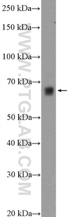 PODN Antibody in Western Blot (WB)