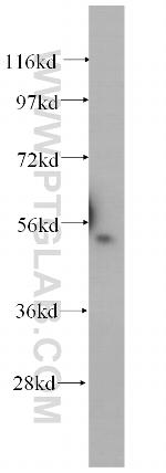 DNPEP Antibody in Western Blot (WB)