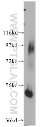DNPEP Antibody in Western Blot (WB)