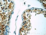 IFT27 Antibody in Immunohistochemistry (Paraffin) (IHC (P))