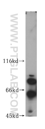 HNRNPR Antibody in Western Blot (WB)