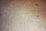 HNRNPR Antibody in Immunohistochemistry (Paraffin) (IHC (P))