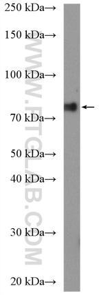 POLR3E Antibody in Western Blot (WB)