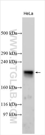 ARHGAP32 Antibody in Western Blot (WB)
