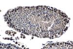 NUP85 Antibody in Immunohistochemistry (Paraffin) (IHC (P))