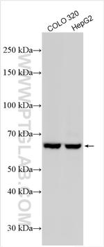 NUP85 Antibody in Western Blot (WB)